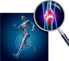 Arthrosis of the knee joint
