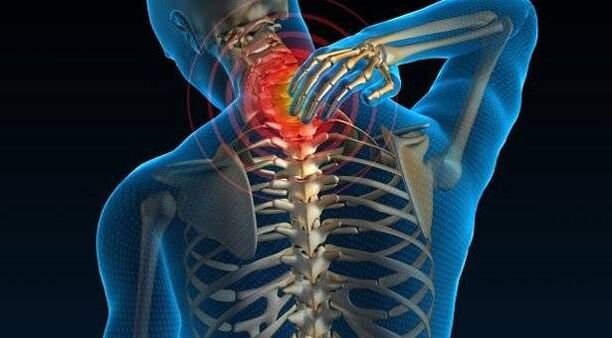 Osteochondritis of the spine