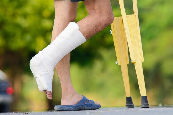 ankle injury as a cause of arthrosis